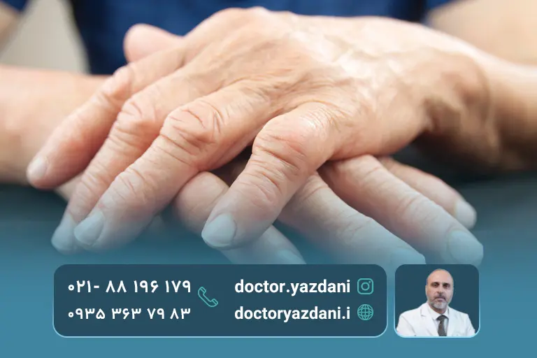 آرتروز انگشتان دست